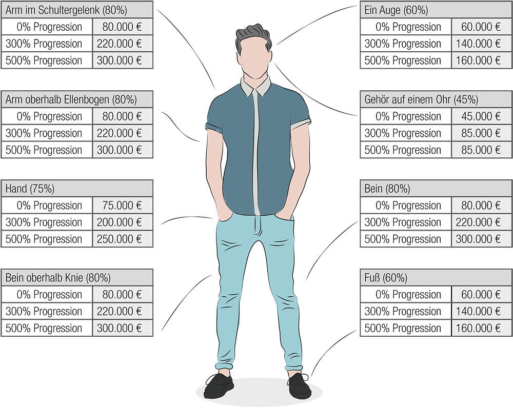 Eine Grafik, die einen Mann zeigt und verschiedene Körperteile mit Schadensgraden und entsprechenden Entschädigungsbeträgen in Euro auflistet.