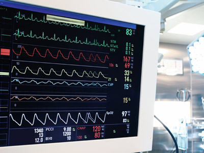 Ein medizinisches Überwachungsgerät mit verschiedenen Vitalzeichen und Wellenformen auf dem Bildschirm.