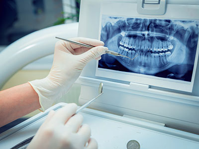 Ein Zahnmediziner betrachtet ein Röntgenbild eines Gebisses.