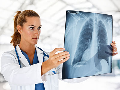 Eine Ärztin betrachtet ein Röntgenbild der Lunge.