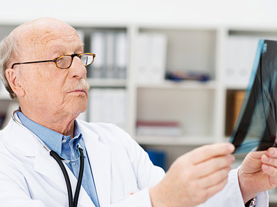 Ein älterer Arzt betrachtet ein Röntgenbild.